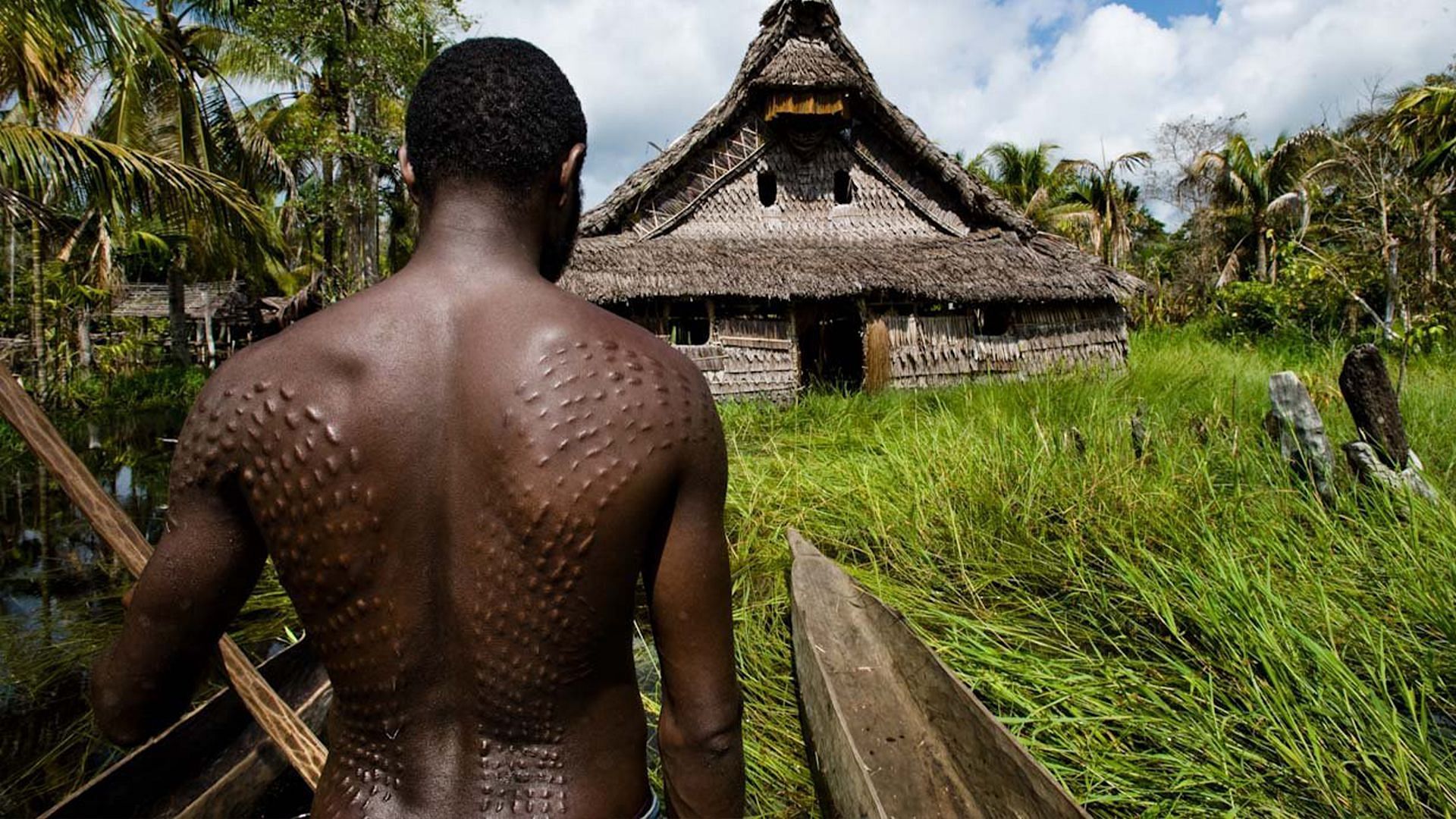 A man with crocodile scars (Image via Getty)